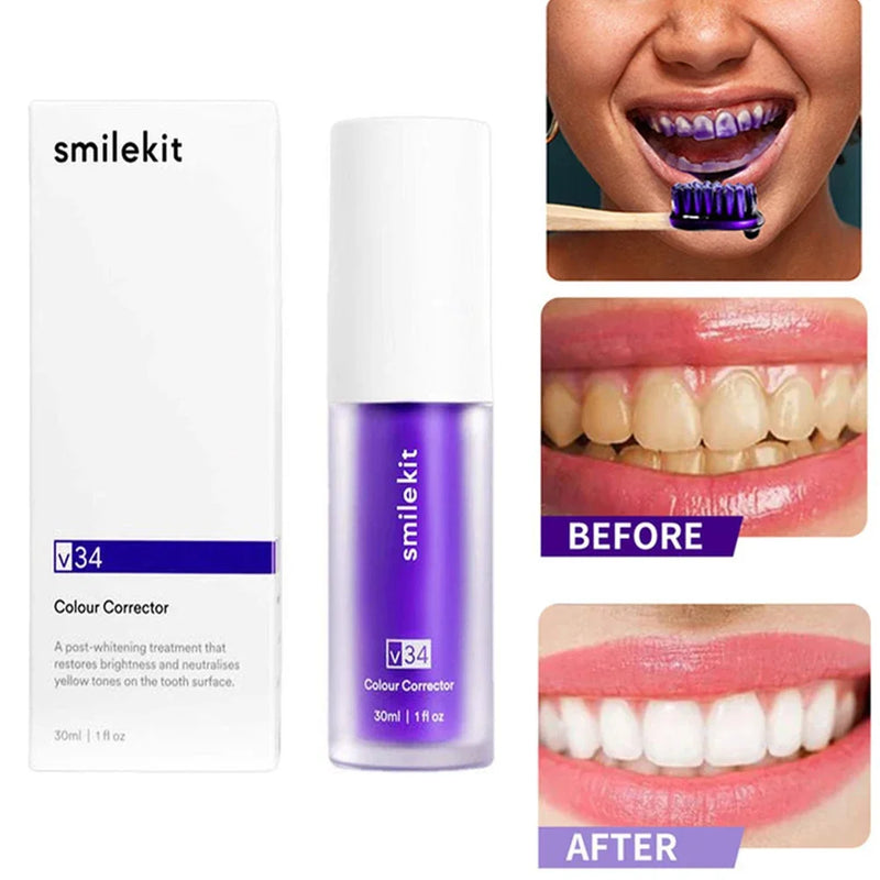Creme dental branqueador SMILEKIT V34 - 30ml - Remove Manchas, Reduz o Amarelamento.